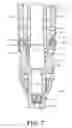 Fig. 07 - Surgical instrument and method for the distraction or compression of bones