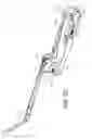 Fig. 22 - Surgical instrument and method for the distraction or compression of bones