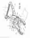 Fig. 41 - Surgical instrument and method for the distraction or compression of bones