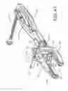 Fig. 43 - Surgical instrument and method for the distraction or compression of bones