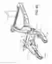 Fig. 45 - Surgical instrument and method for the distraction or compression of bones