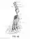 Fig. 49 - Surgical instrument and method for the distraction or compression of bones