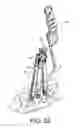 Fig. 52 - Surgical instrument and method for the distraction or compression of bones