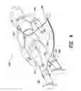 Fig. 04 - Systems and methods for enhanced venous return flow during cardiac event