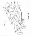 Fig. 05 - Systems and methods for enhanced venous return flow during cardiac event