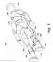 Fig. 06 - Systems and methods for enhanced venous return flow during cardiac event