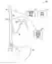 Fig. 01 - Methods and apparatus for controlling neurostimulation using evoked physiologic events