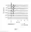 Fig. 08 - Methods and apparatus for controlling neurostimulation using evoked physiologic events