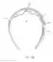 Fig. 08 - Wireless visual prosthesis with remote driver and coil
