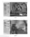 Fig. 06 - Clinician programmer system and method for steering volumes of activation