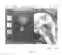 Fig. 08 - Clinician programmer system and method for steering volumes of activation