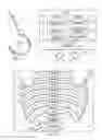 Fig. 02 - Method and apparatus for providing complex tissue stimulation patterns