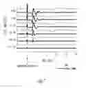 Fig. 08 - Methods and apparatus for adjusting neurostimulation intensity using evoked responses