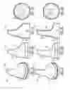 Fig. 07 - Devices and methods for vestibular and/or cranial nerve stimulation