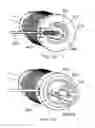 Fig. 49 - Delivery System and Method for Self-Centering a Proximal End of a Stent Graft