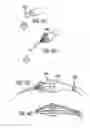 Fig. 63 - Delivery System and Method for Self-Centering a Proximal End of a Stent Graft