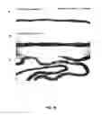Fig. 11 - METHODS FOR GENERATING CARTILAGE TISSUE