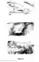 Fig. 14 - METHODS FOR GENERATING CARTILAGE TISSUE