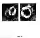 Fig. 15 - METHODS FOR GENERATING CARTILAGE TISSUE