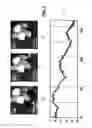 Fig. 07 - METHOD FOR AUTOMATIC ADJUSTMENT OF THE APPLIED FORCE AND CONTROL OF THE FORCE DRIFT IN AN ATOMIC FORCE MICROSCOPE DURING CONTACT MODE IMAGING