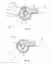 Fig. 02 - Hinge for an orthopedic brace