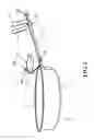 Fig. 02 - Ergonomic anatomical assist system for handled devices