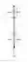 Fig. 01 - SUPPORTING POLE FOR ADVERTISING STRIPS, PANELS, FLAGS OR BANNERS