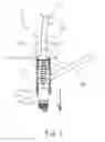 Fig. 07 - Auxiliary tool for assembling and disassembling spark plug