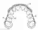Fig. 01 - Orthodontic Pain Shield