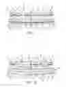 Fig. 02 - Orthodontic Pain Shield