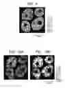 Fig. 06 - Method of forming mass image
