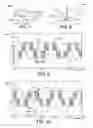 Fig. 07 - Current source converter-based wind energy system