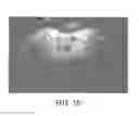 Fig. 12 - ANTENNA ARRAY COMPRISING AT LEAST ONE DIPOLE ANTENNA FOR MAGNETIC RESONANCE IMAGING
