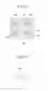 Fig. 07 - Liquid crystal display
