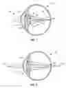 Fig. 02 - Ophthalmic lens, systems and methods with angular varying phase delay