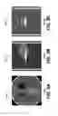 Fig. 07 - Projection truncation processing for CBCT