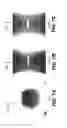 Fig. 09 - Projection truncation processing for CBCT