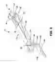 Fig. 04 - Forward extraction force transfer coupling