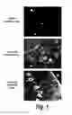 Fig. 02 - Methods and compositions for CNS delivery of iduronate-2-sulfatase
