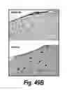 Fig. 43 - Methods and compositions for CNS delivery of iduronate-2-sulfatase