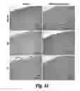 Fig. 41 - METHODS AND COMPOSITIONS FOR CNS DELIVERY OF B-GALACTOCEREBROSIDASE