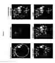 Fig. 10 - Methods of use for an antibody against human frizzled receptors 1, 2. 5, 7 or 8