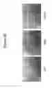 Fig. 46 - Methods of use for an antibody against human frizzled receptors 1, 2. 5, 7 or 8