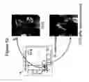 Fig. 49 - Methods of use for an antibody against human frizzled receptors 1, 2. 5, 7 or 8
