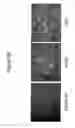 Fig. 57 - Methods of use for an antibody against human frizzled receptors 1, 2. 5, 7 or 8