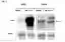 Fig. 03 - Tumor Treatment