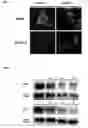 Fig. 06 - Tumor Treatment