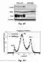 Fig. 11 - Targets for treatment of hypercholesterolemia
