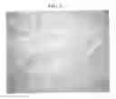 Fig. 07 - METHOD OF DUPLICATING TEXTURE PATTERN ON OBJECT'S SURFACE BY NANO IMPRINTING AND ELECTROFORMING AND PATTERNED DUPLICATION PANEL USING THE SAME
