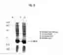 Fig. 07 - PROCESS FOR PRODUCING RECOMBINANT PROTEIN USING NOVEL FUSION PARTNER